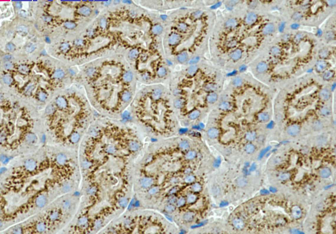 CD63 Rabbit Monoclonal Antibody