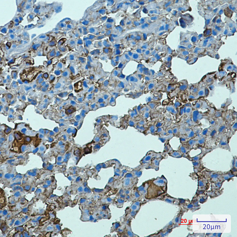 Toll-Like Receptor 2 Rabbit Monoclonal Antibody