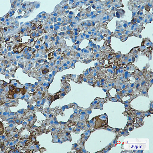 Toll-Like Receptor 2 Rabbit Monoclonal Antibody