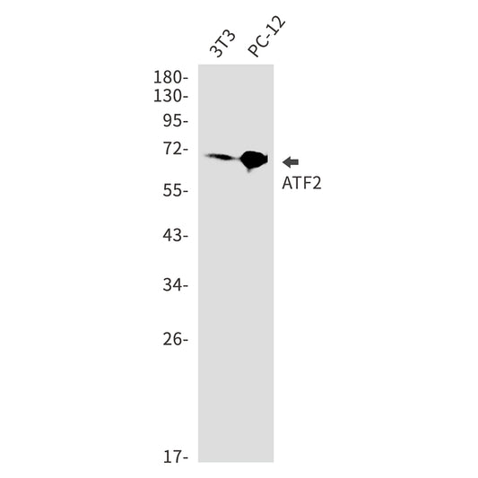 ATF2 Rabbit Monoclonal Antibody