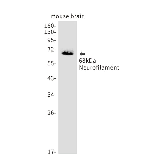 Neurofilament light polypeptide Rabbit Monoclonal Antibody