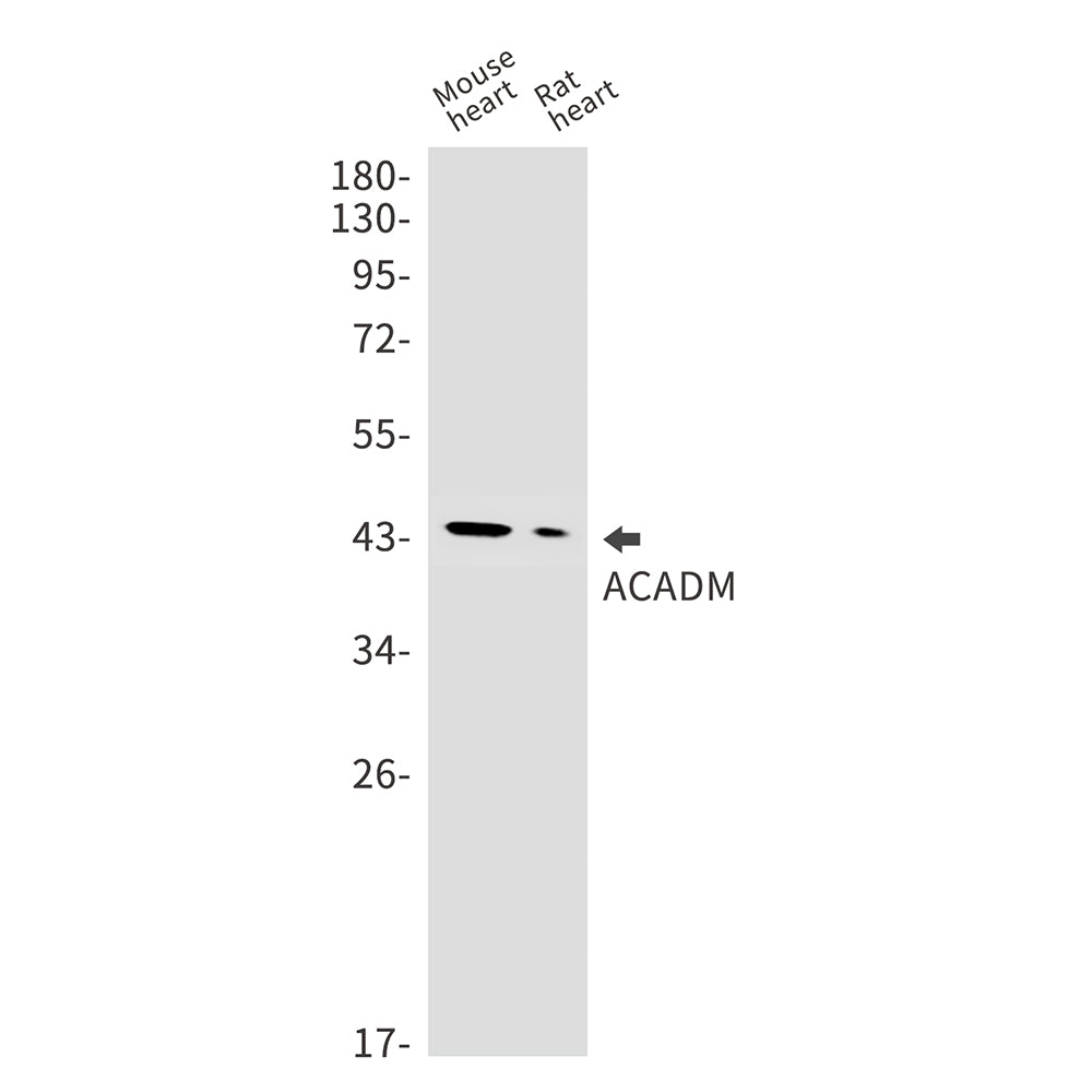 ACADM Rabbit Monoclonal Antibody