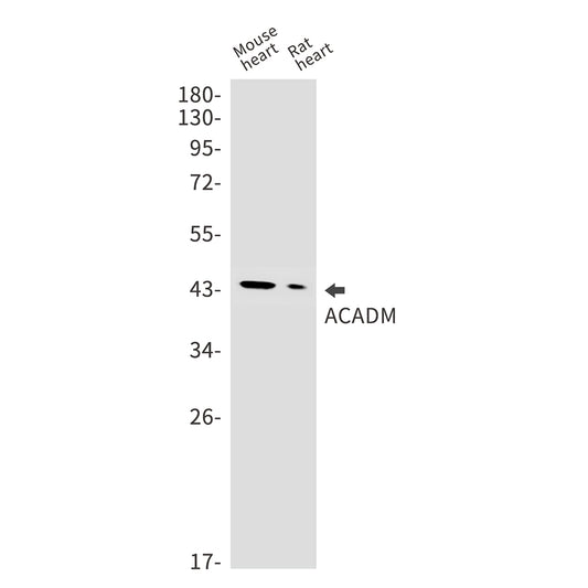 ACADM Rabbit Monoclonal Antibody