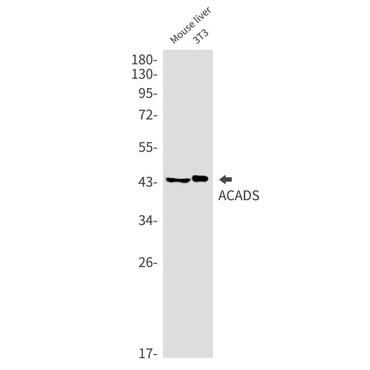 ACADS Rabbit Monoclonal Antibody