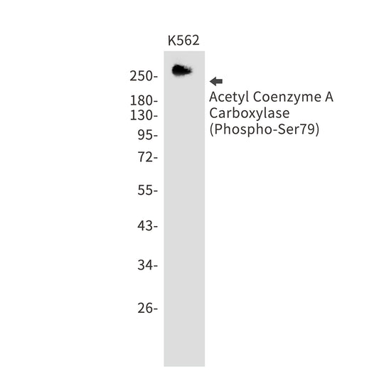 Phospho-Acetyl Coenzyme A Carboxylase (Ser79) Rabbit Monoclonal Antibody