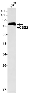 ACSS2 Rabbit Monoclonal Antibody