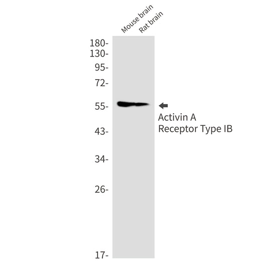 Activin A Receptor Type IB Rabbit Monoclonal Antibody