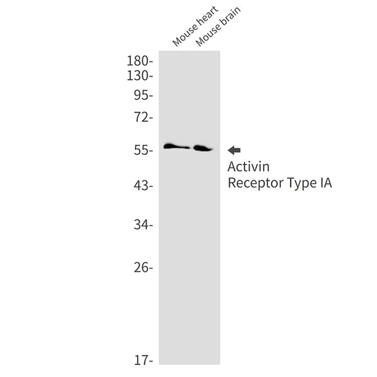 Activin Receptor Type IA Rabbit Monoclonal Antibody