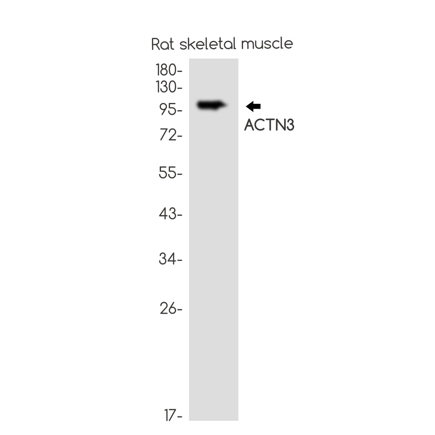 ACTN3 Rabbit Monoclonal Antibody