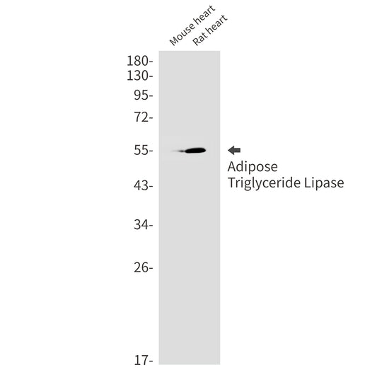 Adipose Triglyceride Lipase Rabbit Monoclonal Antibody