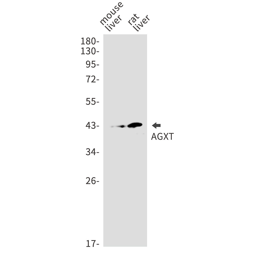AGXT Rabbit Monoclonal Antibody