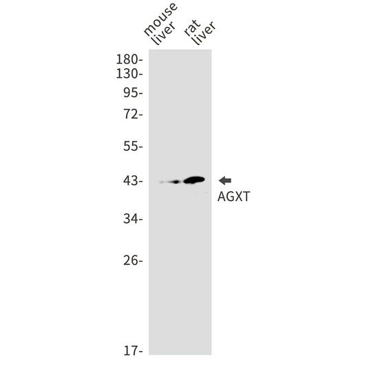 AGXT Rabbit Monoclonal Antibody