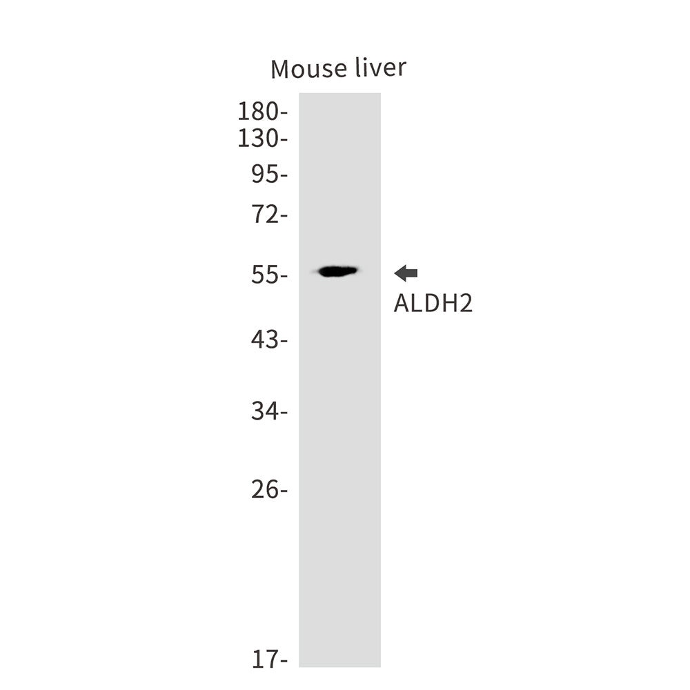 ALDH2 Rabbit Monoclonal Antibody