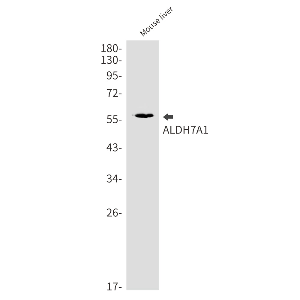 ALDH7A1 Rabbit Monoclonal Antibody