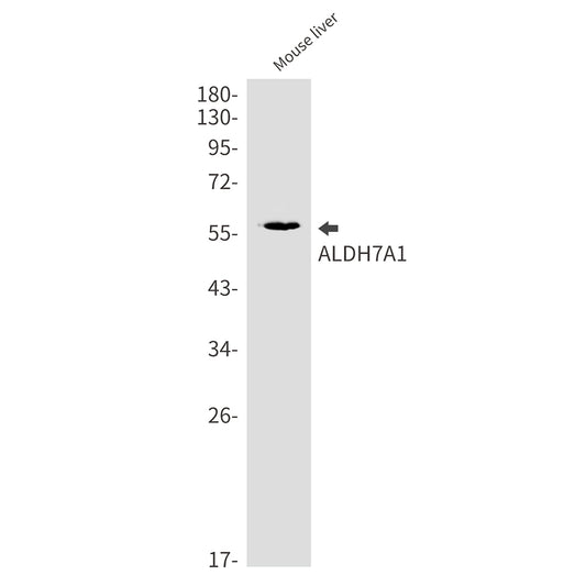 ALDH7A1 Rabbit Monoclonal Antibody