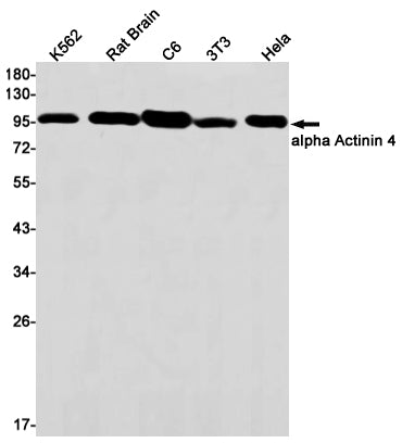 alpha Actinin 4 Rabbit Monoclonal Antibody