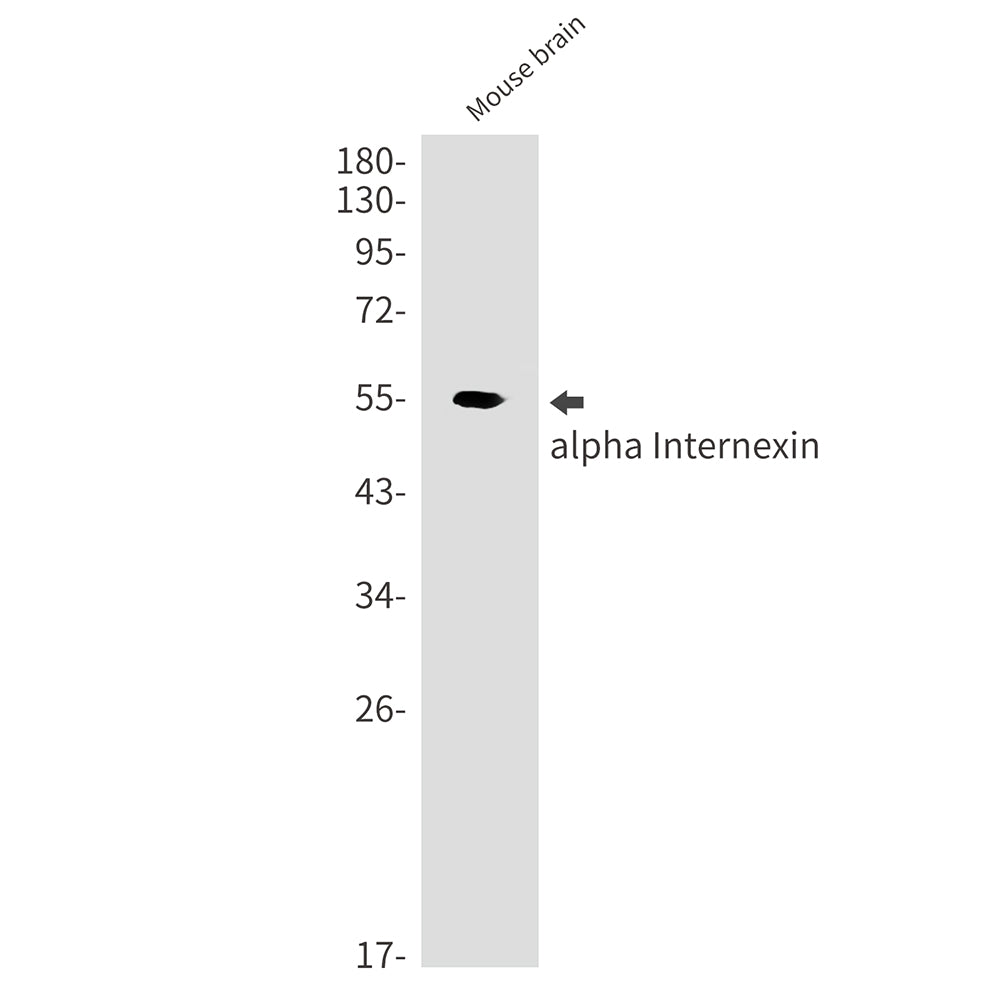 alpha Internexin Rabbit Monoclonal Antibody
