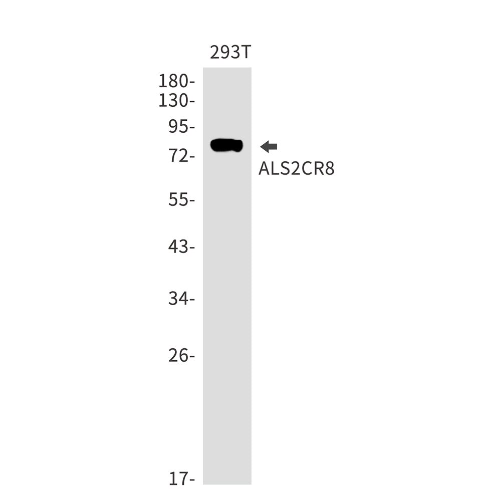 ALS2CR8 Rabbit Monoclonal Antibody