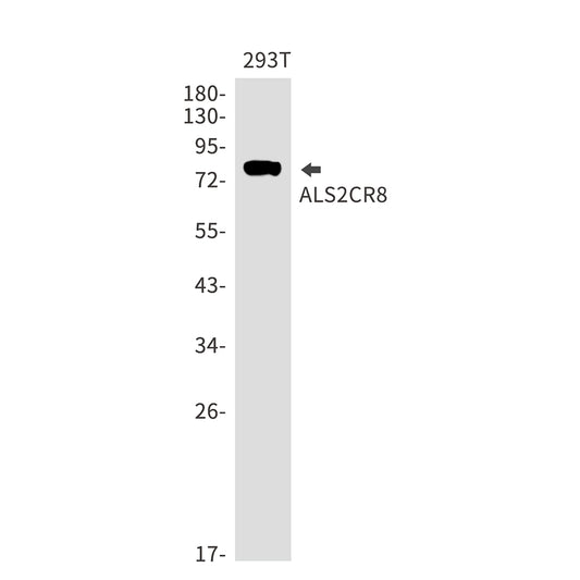 ALS2CR8 Rabbit Monoclonal Antibody