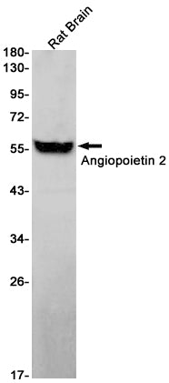 Angiopoietin 2 Rabbit Monoclonal Antibody
