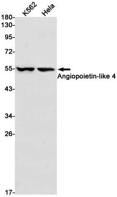 Angiopoietin Like 4 Rabbit Monoclonal Antibody