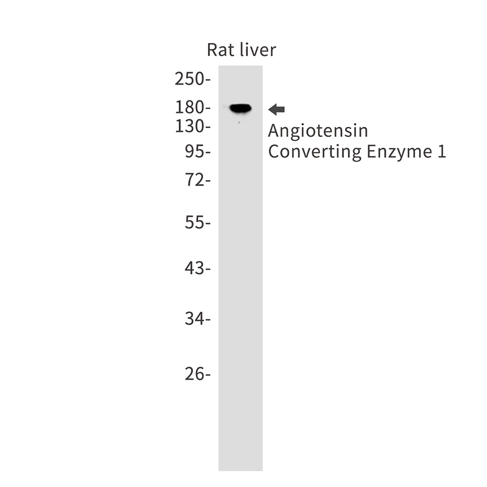 Angiotensin Converting Enzyme 1 Rabbit Monoclonal Antibody