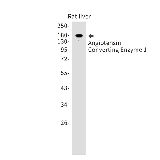 Angiotensin Converting Enzyme 1 Rabbit Monoclonal Antibody