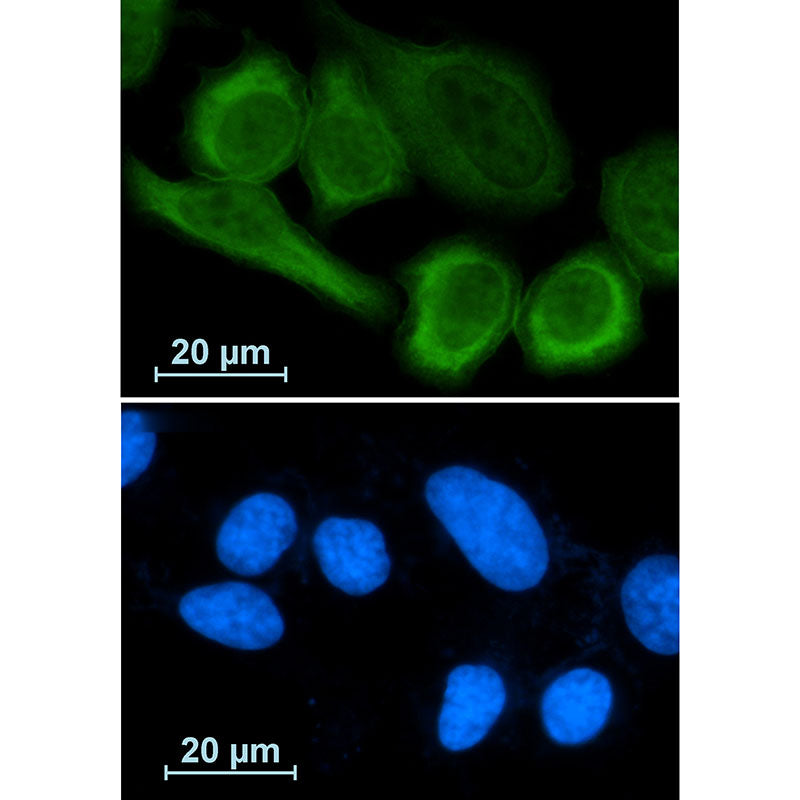Annexin A1 Rabbit Monoclonal Antibody