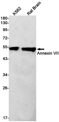 Annexin VII Rabbit Monoclonal Antibody