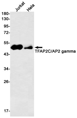 Transcription Factor AP 2 gamma Rabbit Monoclonal Antibody