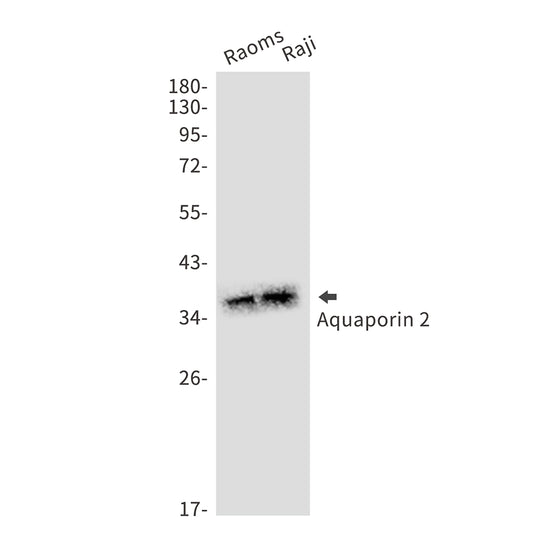 Aquaporin 2 Rabbit Monoclonal Antibody
