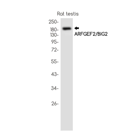 ARFGEF2 Rabbit Monoclonal Antibody