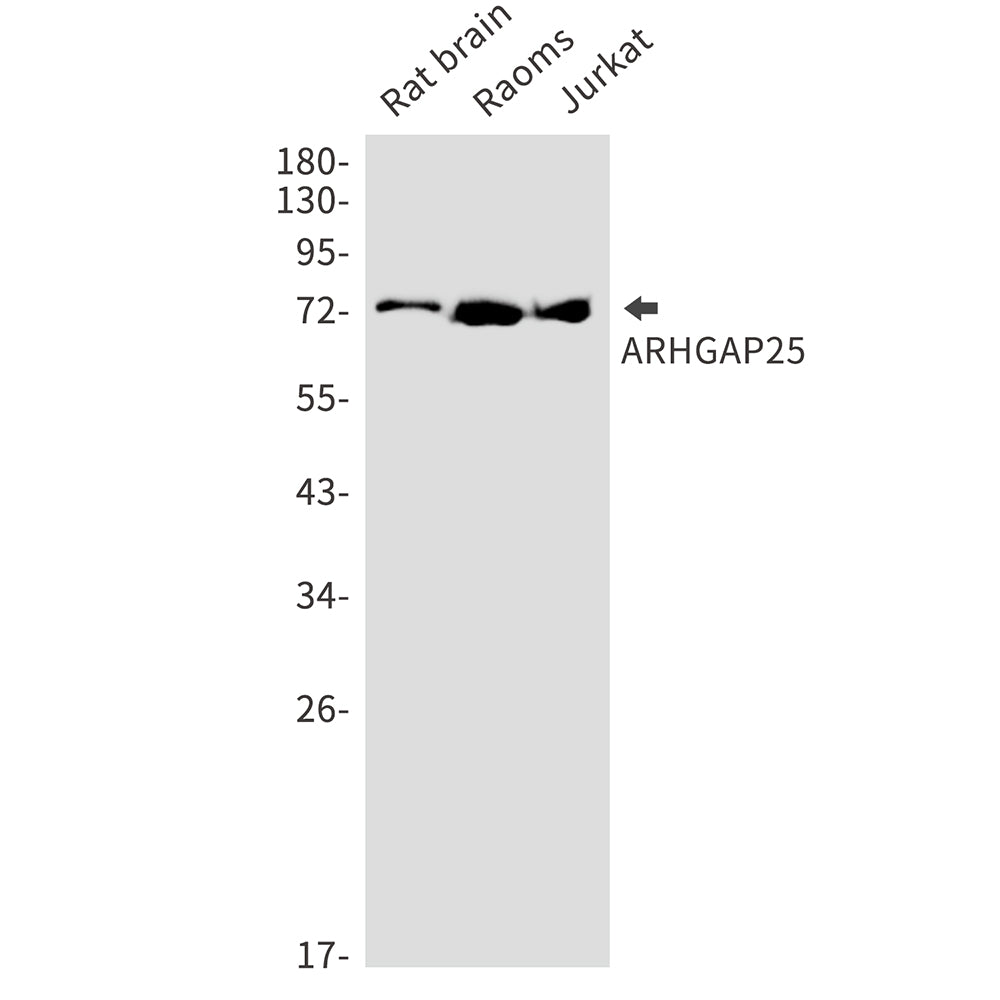 ARHGAP25 Rabbit Monoclonal Antibody