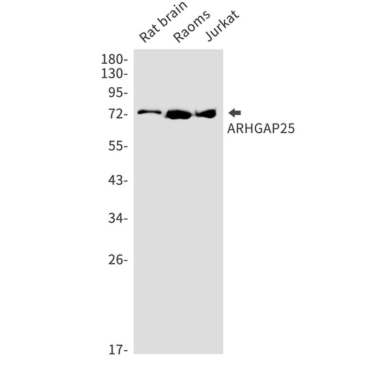 ARHGAP25 Rabbit Monoclonal Antibody