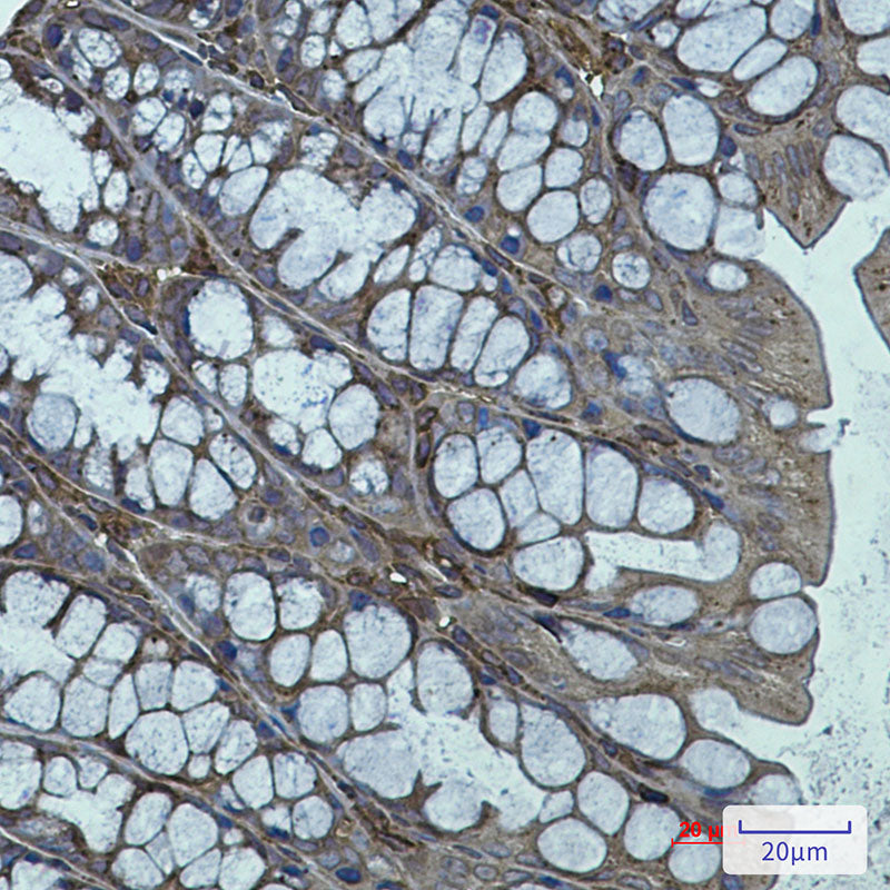 Actin Related Protein 3 Rabbit Monoclonal Antibody