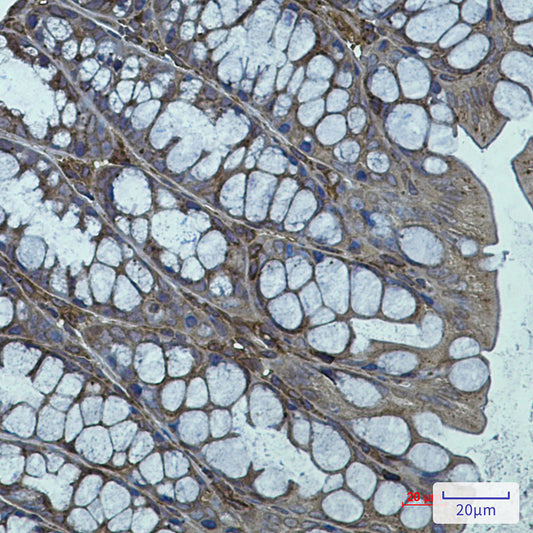 Actin Related Protein 3 Rabbit Monoclonal Antibody
