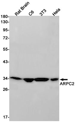 ARPC2 Rabbit Monoclonal Antibody