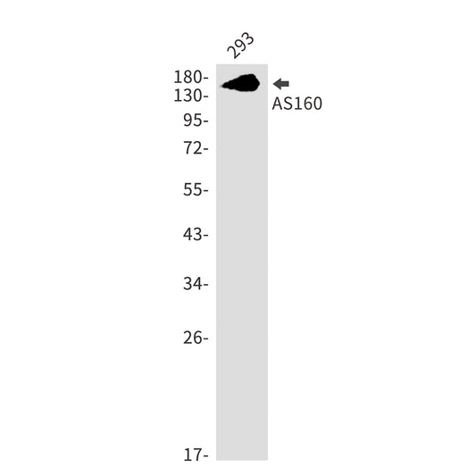 AS160 Rabbit Monoclonal Antibody
