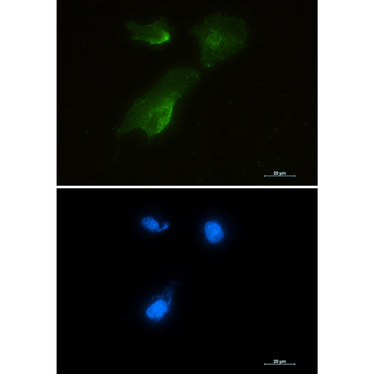 Aspartate Aminotransferase Rabbit Monoclonal Antibody