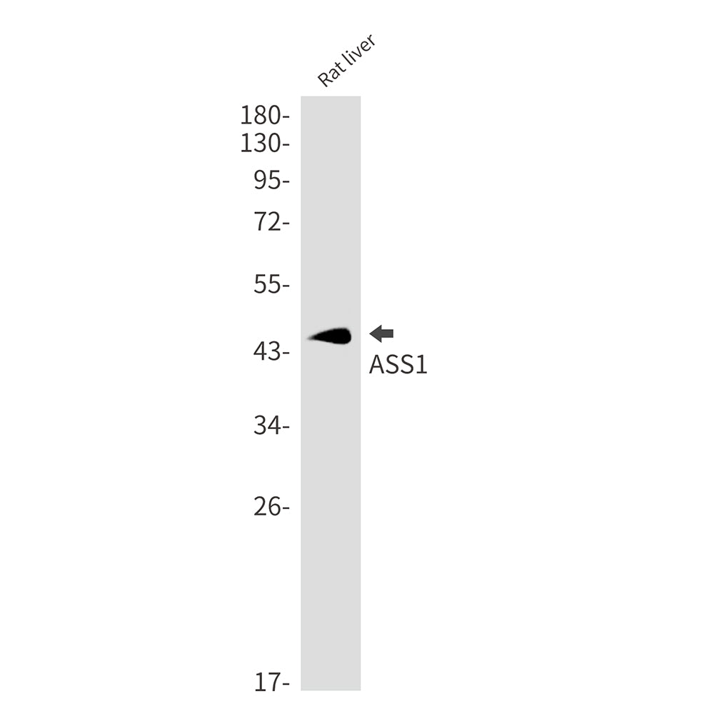 ASS1 Rabbit Monoclonal Antibody
