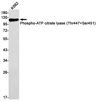 Phospho-ATP Citrate Synthase (Thr447/Ser451) Rabbit Monoclonal Antibody