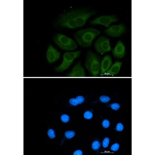 ATP Citrate lyase Rabbit Monoclonal Antibody