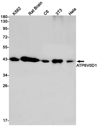 ATP6V0D1 Rabbit Monoclonal Antibody