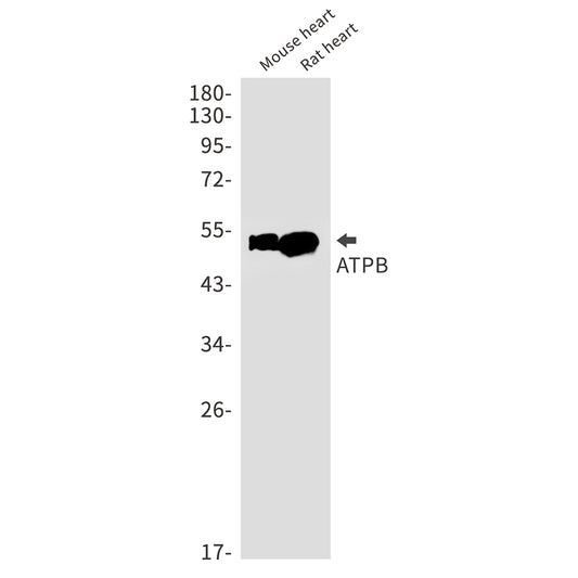 ATPB Rabbit Monoclonal Antibody