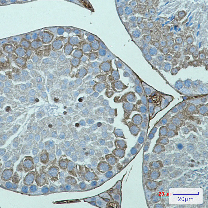 AVEN Rabbit Monoclonal Antibody
