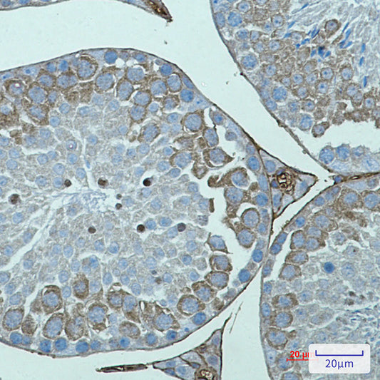 AVEN Rabbit Monoclonal Antibody
