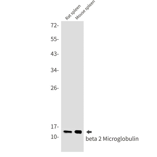 beta 2 Microglobulin Rabbit Monoclonal Antibody