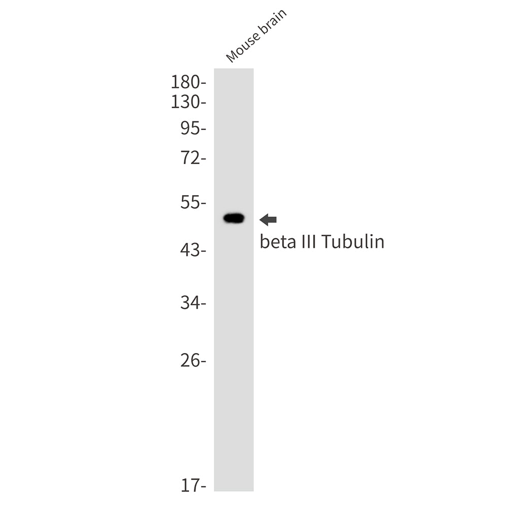 beta III Tubulin Rabbit Monoclonal Antibody