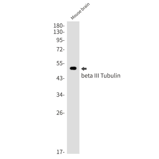 beta III Tubulin Rabbit Monoclonal Antibody