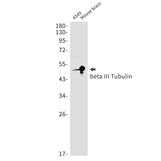 beta III Tubulin Rabbit Monoclonal Antibody
